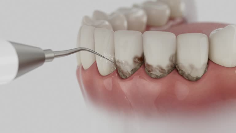 Trusted Teeth Cleaning And Checkup service in North Decatur, GA - Dentist Open Now
